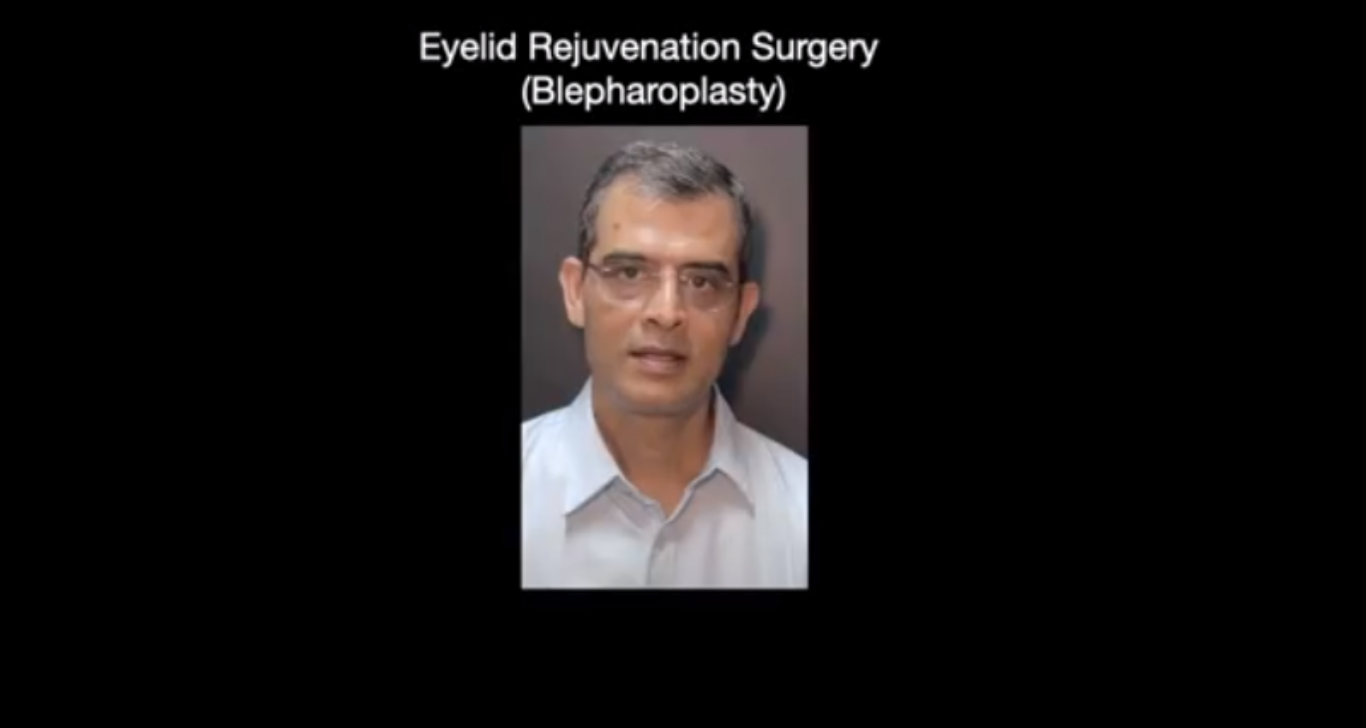 Eyelid rejuvenation surgery
